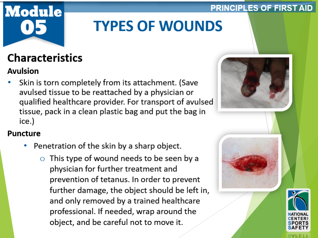 Types Of Wounds And Examples