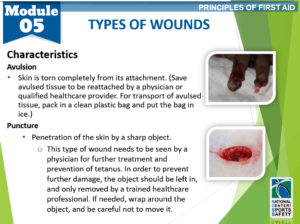 10-types-of-wounds3 – National Center for Sports Safety