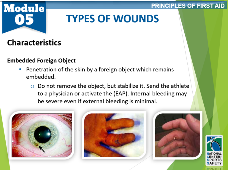 11-types-of-wounds4-national-center-for-sports-safety