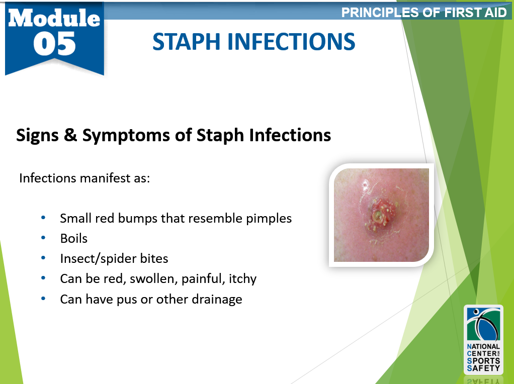 Types Of Staph Skin Infections 