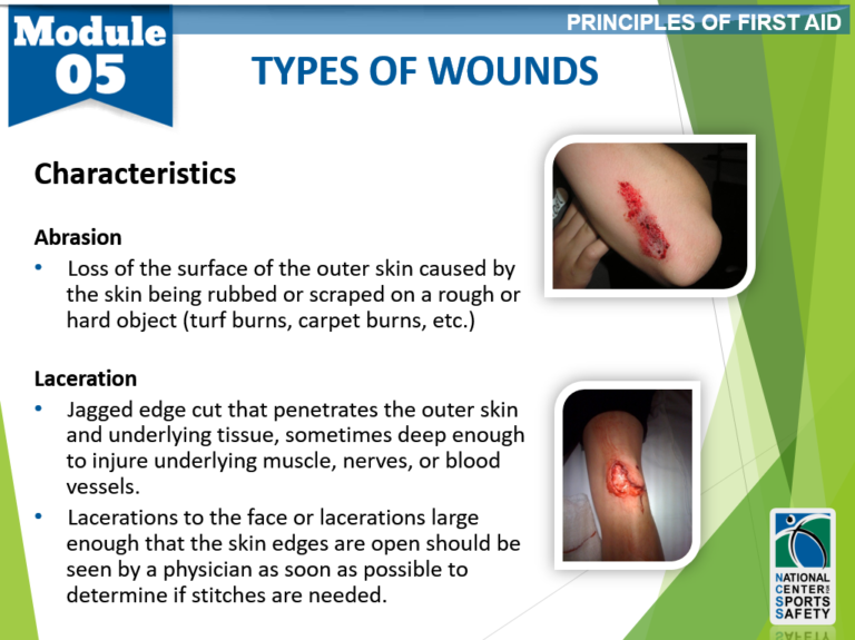 List The Three Types Of Wounds Should Be Referred To A Physician